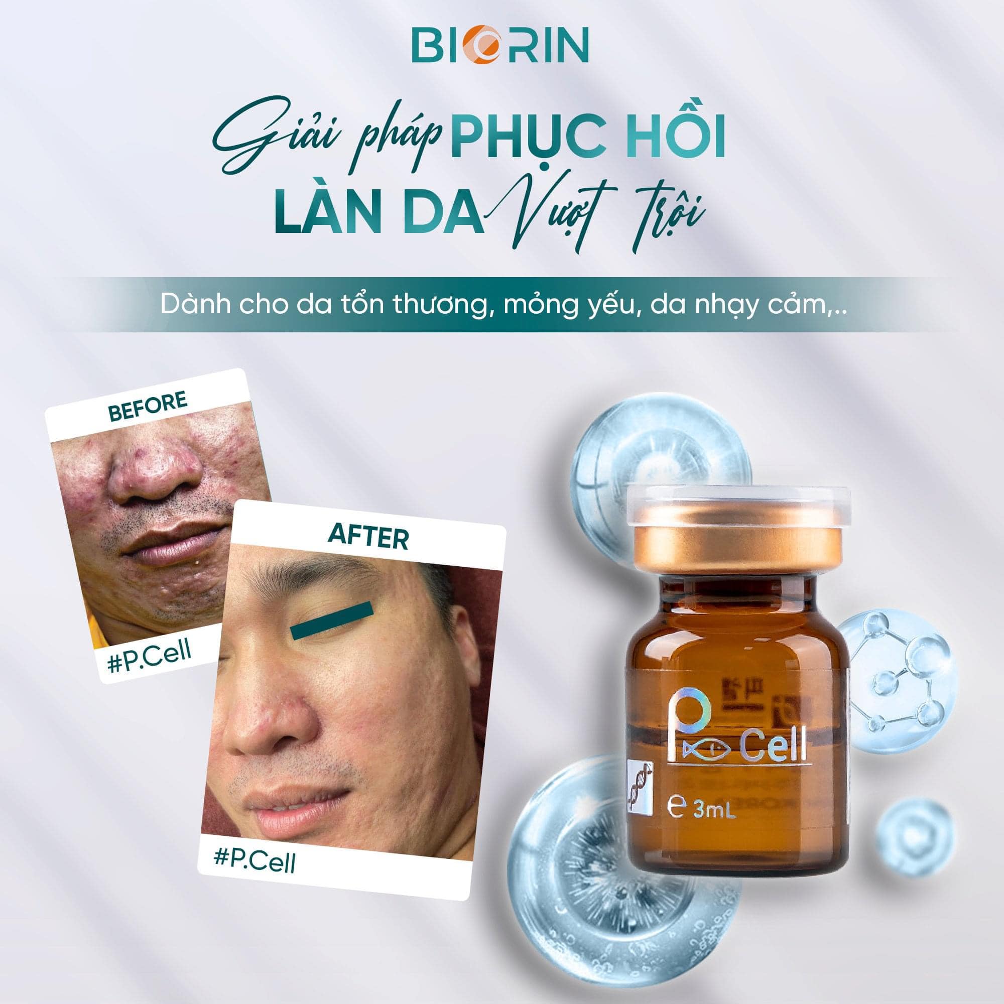 447278244_2441006582765752_7129010909191046006_n "Tinh Chất Cấy Meso Borin P – CELL HA + DNA Cá Hồi” đang ngày càng được nhiều chủ spa, clinic tin dùng.