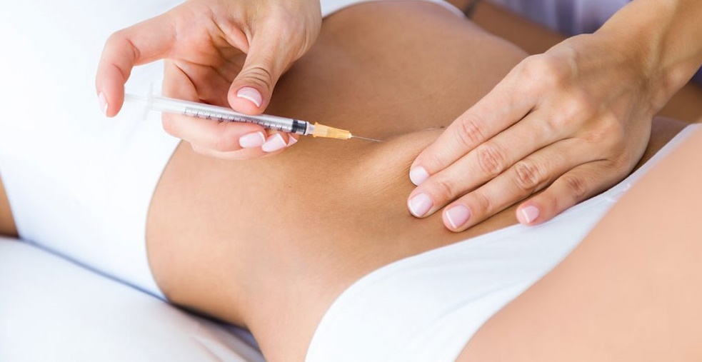 Liệu pháp tiêm tan mỡ Mesotherapy là một phương pháp xâm lấn tối thiểu bằng hình thức tiêm