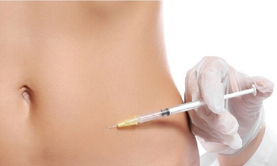 Liệu pháp Mesotherapy tiêm tan mỡ thừa